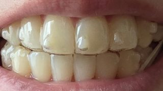 Thumbnail of post image 121